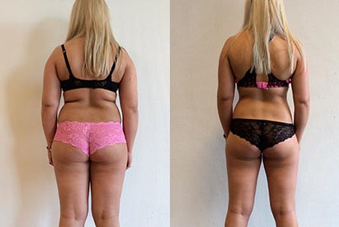 Katrine taber sig over 9 kg på 12 uger